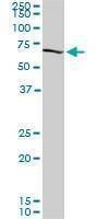 Anti-CROT Antibody