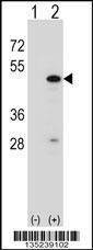 Anti-RBM22 (Center) Antibody