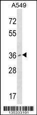 Anti-PCGF2 (Center) Antibody