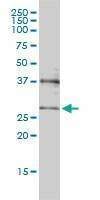 Anti-CRSP9 Antibody