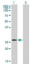 Anti-CRSP9 Antibody
