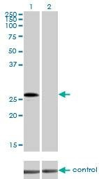 Anti-CRSP9 Antibody