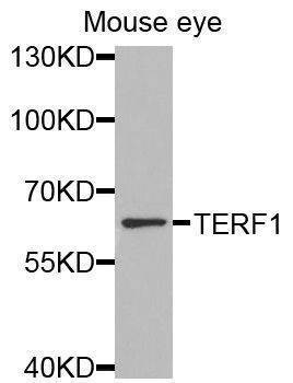 Anti-TERF1 Antibody