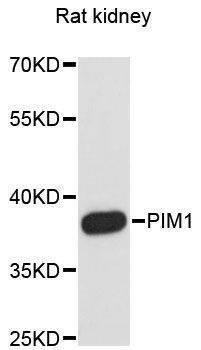 Anti-PIM1 Antibody