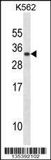 Anti-PRL (C-term) Antibody