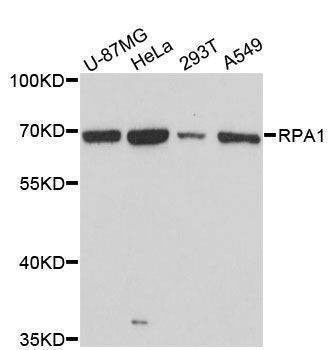 Anti-RPA1 Antibody