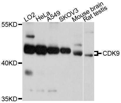 Anti-CDK9 Antibody