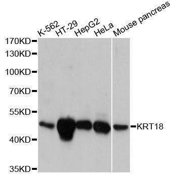 Anti-KRT18 Antibody