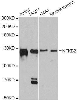 Anti-NFKB2 Antibody