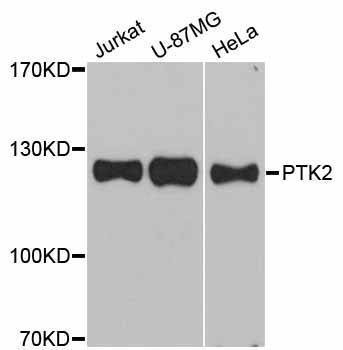 Anti-PTK2 Antibody
