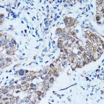 Anti-CASP3 Antibody