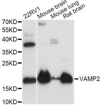 Anti-VAMP2 Antibody