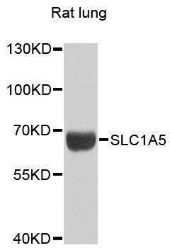 Anti-SLC1A5 Antibody