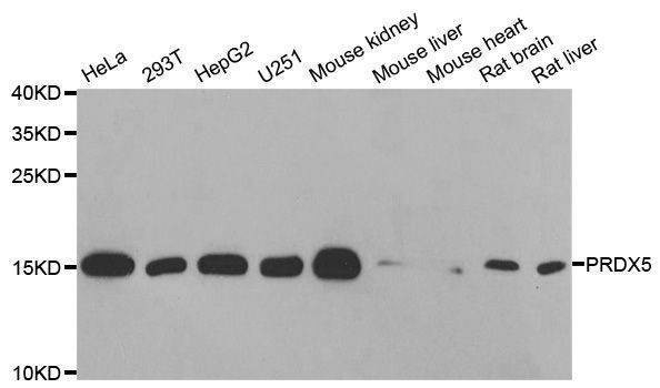 Anti-PRDX5 Antibody