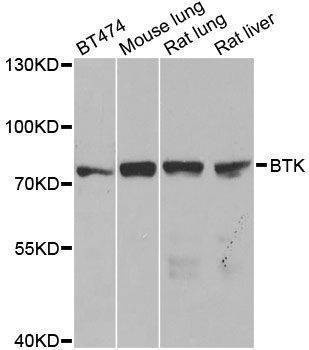Anti-BTK Antibody