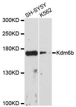Anti-Kdm6b Antibody