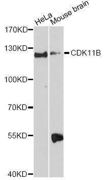 Anti-CDK11B Antibody