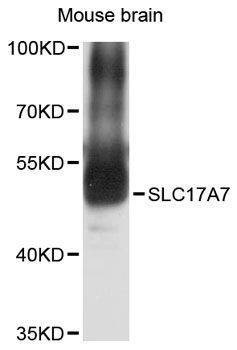 Anti-SLC17A7 Antibody