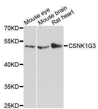 Anti-CSNK1G3 Antibody