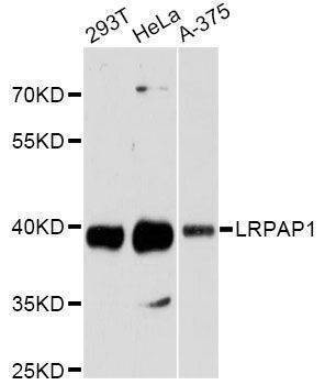 Anti-LRPAP1 Antibody