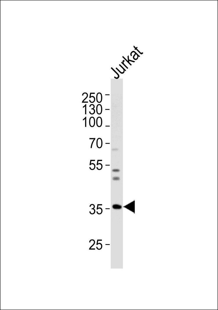 Anti-GLRB (N-term) Antibody