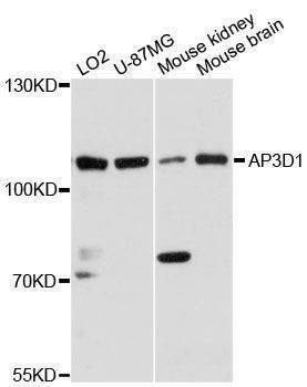 Anti-AP3D1 Antibody