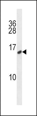 Anti-CALCA/CT (C-term) Antibody