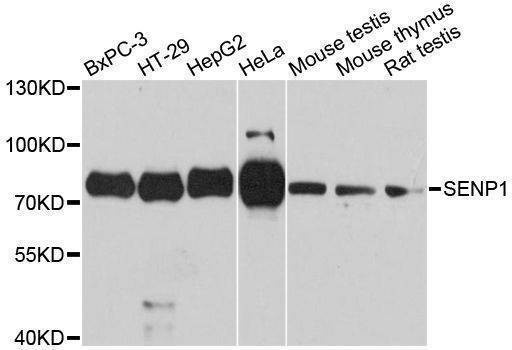 Anti-SENP1 Antibody