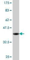 Anti-CRYAB Antibody