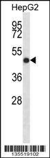Anti-IHH (N-term) Antibody