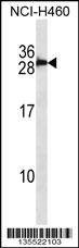 Anti-S100B/S-100 (Center) Antibody