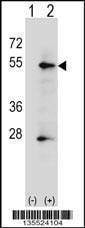 Anti-ALPP (N-term) Antibody