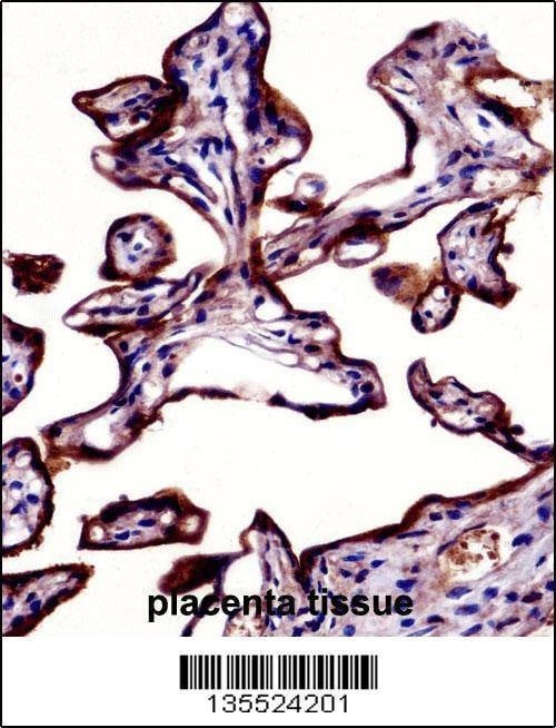 Anti-ALPP (N-term) Antibody