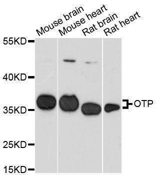 Anti-OTP Antibody