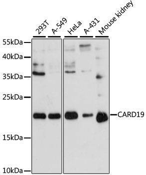 Anti-CARD19 Antibody