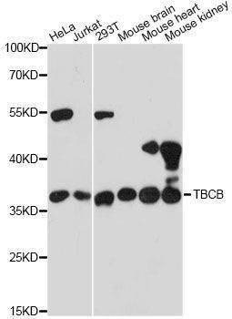 Anti-TBCB Antibody
