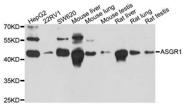 Anti-ASGR1 Antibody
