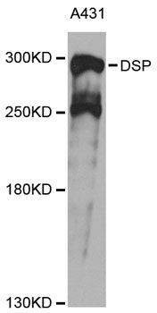 Anti-DSP Antibody