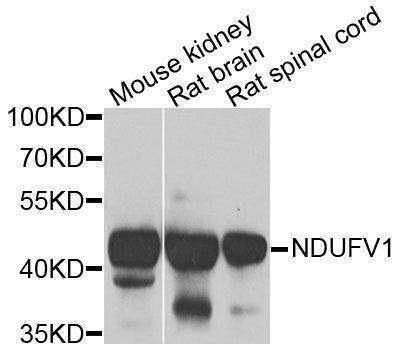 Anti-NDUFV1 Antibody