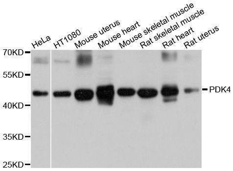 Anti-PDK4 Antibody