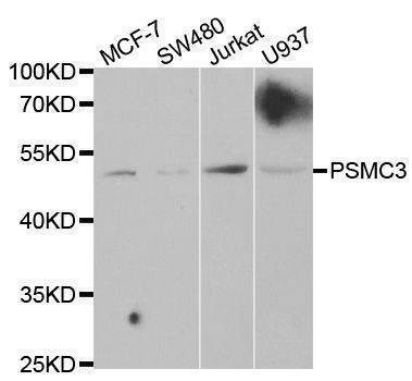 Anti-PSMC3 Antibody