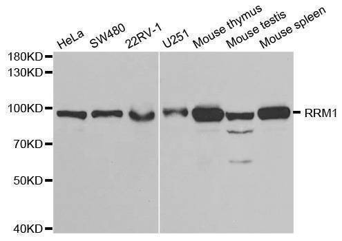 Anti-RRM1 Antibody
