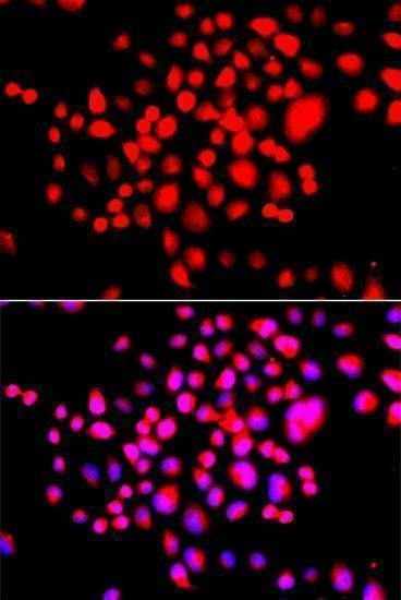 Anti-STK19 Antibody