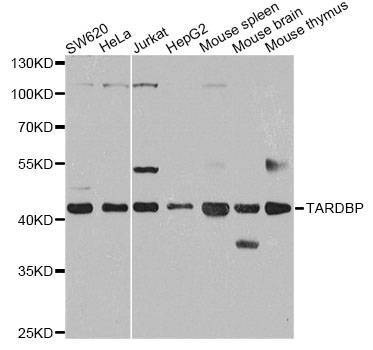 Anti-TARDBP Antibody
