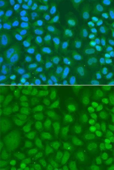 Anti-CXXC1 Antibody