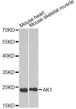 Anti-AK1 Antibody