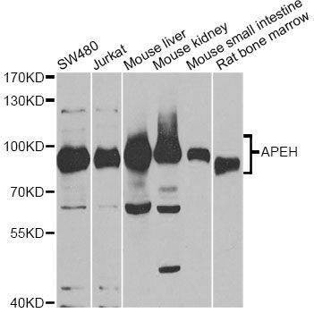 Anti-APEH Antibody