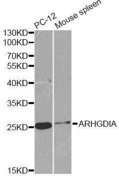 Anti-ARHGDIA Antibody