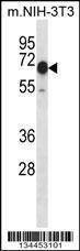 Anti-Camkk2 (N-term) Antibody