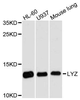 Anti-LYZ Antibody